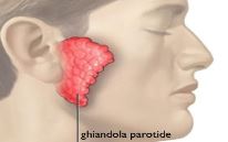 Parotidectomia